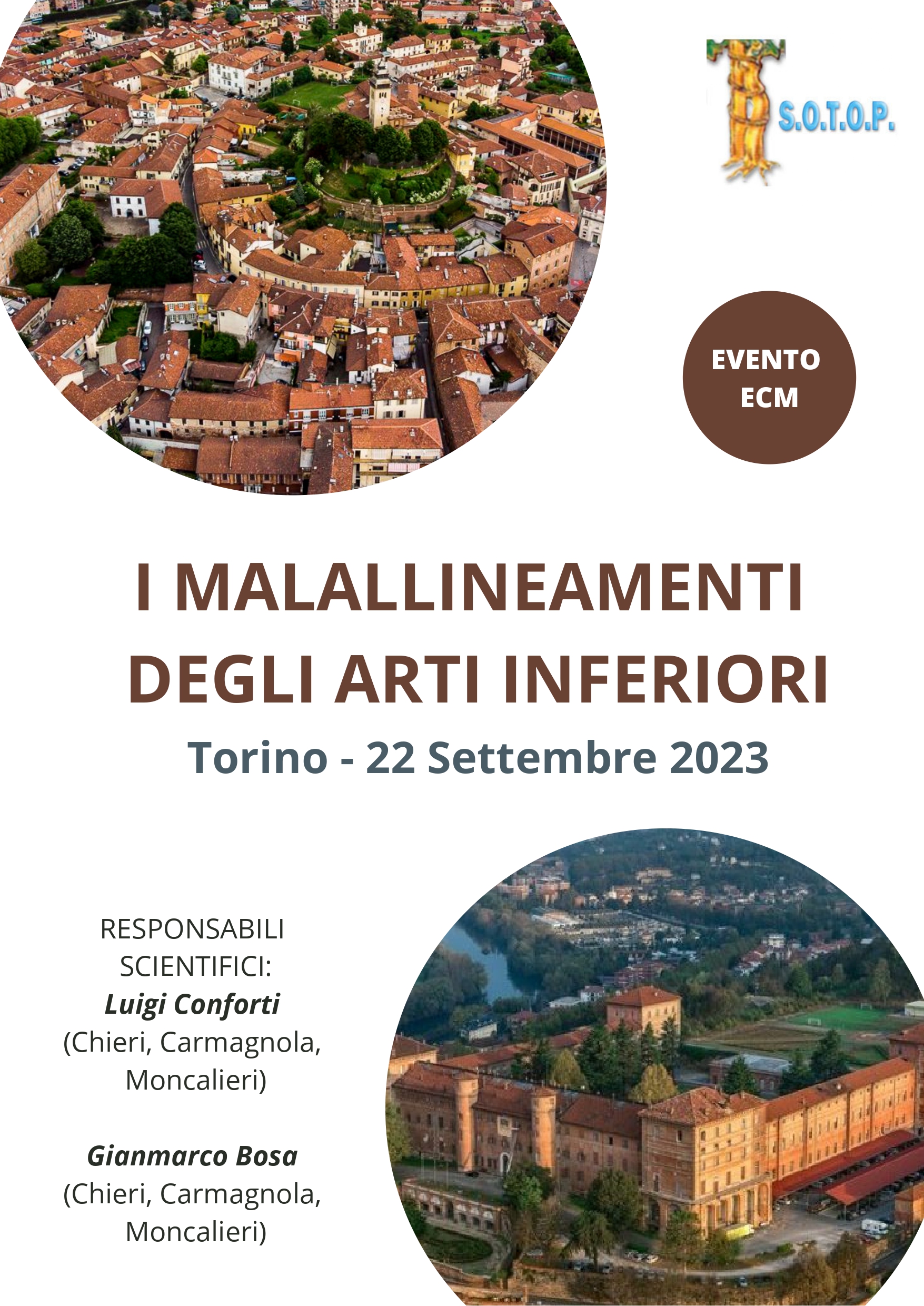 I Malallineamenti degli arti inferiori